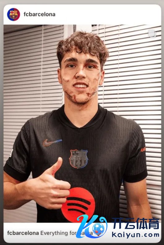 巴萨17岁小将比赛中受伤面部缝10针 晒图竖大拇指